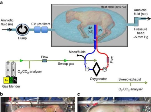 Uteri artificiali e gravidanze digitali: la frontiera tecnologica che sta rivoluzionando il futuro della procreazione